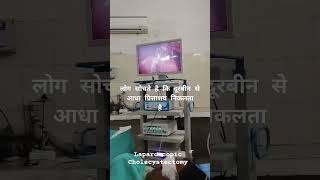 Laparoscopic Cholecystectomy RML hospital gall bladder surgeryपित्ते मै पथरी [upl. by Idnam492]