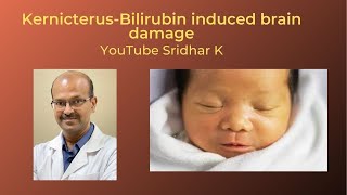 Kernicterus and BIND bilirubin induced neurologic damage Dr Sridhar K [upl. by Llenrep]