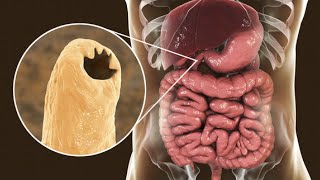 Phylum Nematoda Part 2 The Parasitic Nematodes [upl. by Yalc]