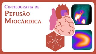 Cintilografia de Perfusão Miocárdica [upl. by Avan]