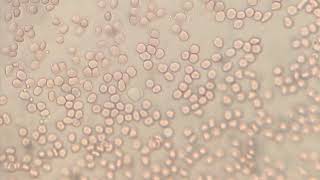 Crawling amoeboid movement white blood cells leukocytes [upl. by Loats]