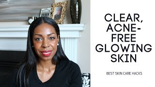 My Skincare Routine For Clear AcneFree Skin [upl. by Patrizio474]