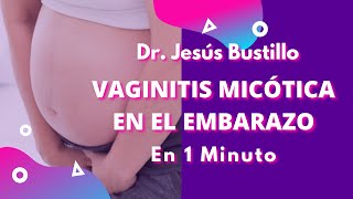 Vaginitis Micotica en el Embarazo [upl. by Egdamlat952]