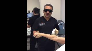 Age Spot Removal of arms at Laser Clinique [upl. by Einned]