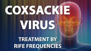 Coxsackie Virus  RIFE Frequencies Treatment  Energy amp Quantum Medicine with Bioresonance [upl. by Woodsum]