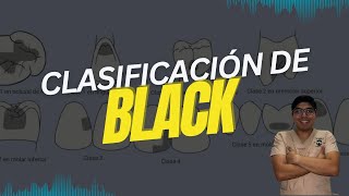 CLASIFICACIÓN DE BLACK [upl. by Nimra]