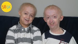 Brothers with the Same Rare Condition Growing up with Progeria [upl. by Racklin]