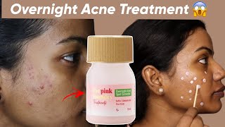 I Tried An Overnight Pimple Treatment OMG Shocking Results 😲 [upl. by Sebastian]