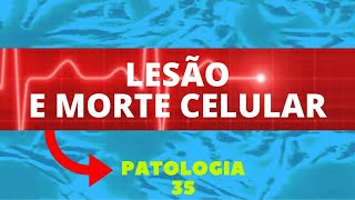 LESÃO E MORTE CELULAR  RESUMÃO TOP  PATOLOGIA 35 [upl. by Carpenter]