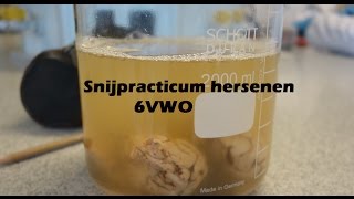 10042017 Snijpracticum hersenen 6VWO [upl. by Mandy]