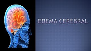 Neurocirujano  ¿ Qué es un edema Cerebral  síntomas y tratamiento 🧠 [upl. by Atiuqnahs]