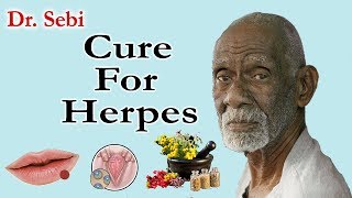 How Dr Sebi Cured Herpes  Complete Guide To Dr Sebi Cure For Herpes [upl. by Ellek529]