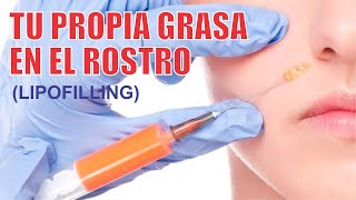 LIPOFILLING o LIPOTRANSFERENCIA al ROSTRO 👸🏻 Tu propia GRASA en el rostro ❤️ Dra LIZBETH ZUÑIGA [upl. by Kenward]