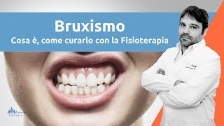 Bruxismo  Cosa è come curarlo DEFINITAMENTE [upl. by Atirahs]