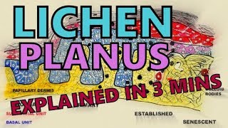 लाइकेन क्या है What Is Iichen In Hindi What Is Lichen In Biology  Economic Importance Of Lichen [upl. by Nomaj]