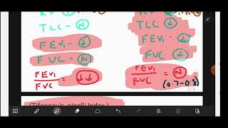 SPIROMETRY  Obstructive Vs Restrictive Lung Diseases  EASY Explained and Mnemonics  neetpg [upl. by Whittaker]