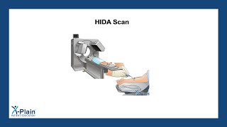 Gallbladder Scan Techniques Subcostal Midclavicular Window [upl. by Danforth159]