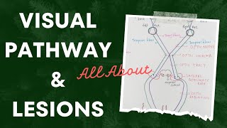 Visual Pathway and Lesions  Special Senses  Eye Physiology [upl. by Thorrlow137]