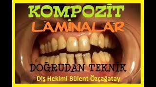 Doğrudan Teknik Kompozit Laminalar 93 [upl. by Urbano]