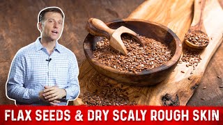 Flaxseed Benefits for Skin amp Symptoms of Linoleic Acid Deficiency – Dr Berg [upl. by Bonnell]