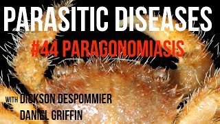 Parasitic Diseases Lectures 44 Paragonomiasis [upl. by Yardna]