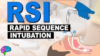 What is Rapid Sequence Intubation RSI [upl. by Caraviello]