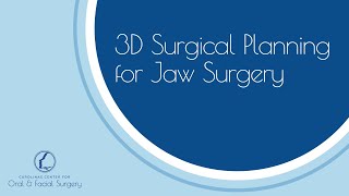 3D Surgical Planning for Jaw Surgery  Short [upl. by Silrac]