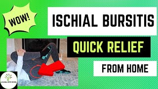 Ischial Bursitis  Sit Bone Pain  Live Well With Dr Mel [upl. by Dallis]