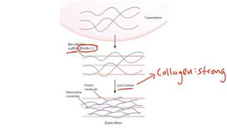 USMLE Step 1 Connective Tissue [upl. by Atnahs]