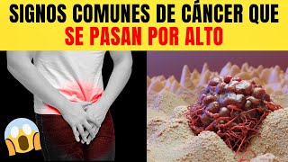 ¡ATENCION 9 Signos comunes e ignorados de CÁNCER [upl. by Gamages245]