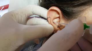 Kulak Conch Piercing Delimi Acı Sıfır [upl. by Ruthven]