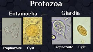 microscopical exam Protozoal trophozoites amp cysts [upl. by Aissela]