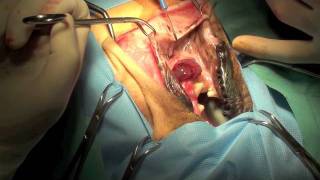 Maxillectomy with Carotid Ligation Dog Surgery At Specialist Veterinary Hospital Melbourne [upl. by Idola]