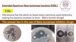 ESBL bacteria Extended Spectrum Betalactamase Bacteria  Antibiotic Resistance English [upl. by Merv]