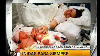 Las gemelas que nacieron tomadas de la mano  Telefe Noticias [upl. by Carder519]