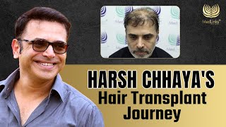 Harsh Chhayas Hair Transplant Journey  Celebrity Hair Transplant  Medlinks [upl. by Lorelei]