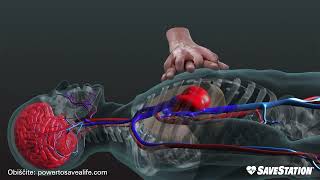 SLOVENIAN Kako poteka kardiopulmonalno oživljanje  3D pogled v notranjost telesa [upl. by Nylcsoj760]