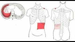 Why Pleurisy pain  Pleuritis pain is referred to the anterior abdominal wall [upl. by Sudbury]