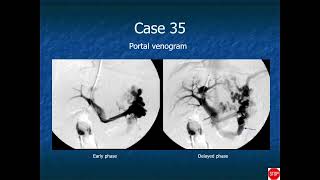 RADIOLOGY EXAM CASES [upl. by Atteugram384]