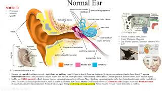 Pathology Made EasySystemic Pathology 15Head amp Neck Diseases3ENT Diseases1Ear amp Nose diseases [upl. by Leaper417]