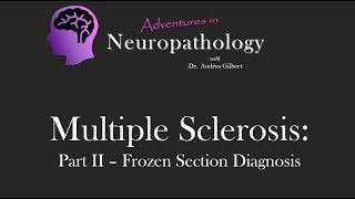 Multiple Sclerosis Part II Frozen Section Diagnosis  Adventures in Neuropathology [upl. by Acinej]