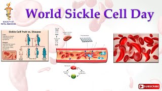 World Sickle Cell Day Awareness 2024 [upl. by Wartow177]