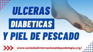 📢 ULCERAS DIABETICAS y Piel de Pescado 🐟 [upl. by Ecille]