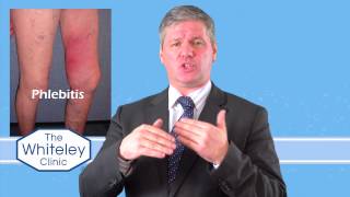 Phlebitis  What is phlebitis and how should phlebitis be treated [upl. by West]