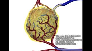 Transarterial Chemoembolization for HCC  Supplementary video ID 433409 [upl. by Yreffej]