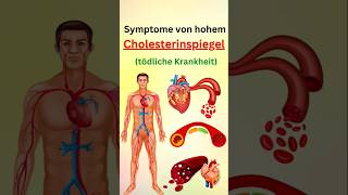 Symptome von hohem cholesterinspiegel [upl. by Rahr411]