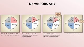 Intro to EKG Interpretation  Rate and Axis [upl. by Aihsiym996]