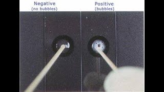 Catalase Test  How to perform [upl. by Blanche]