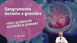 Gravidez 8 semanas  Sangramento com descolamento e risco de aborto Quais as possíveis causas [upl. by Siloa]