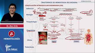 Trastornos de la hemostasia Coagulación intravascular diseminada Hematología 2024 [upl. by Hiroshi244]